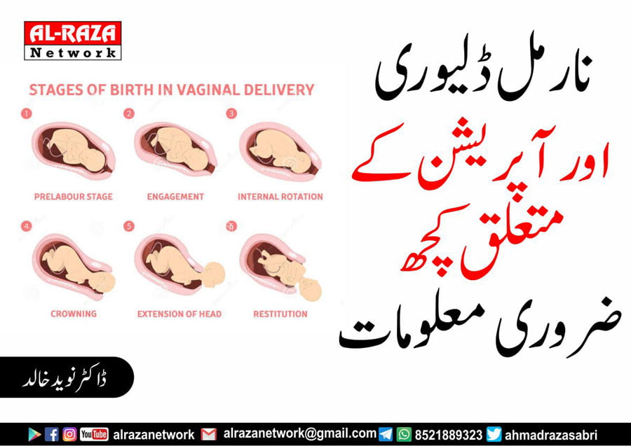 نارمل ڈیلیوری